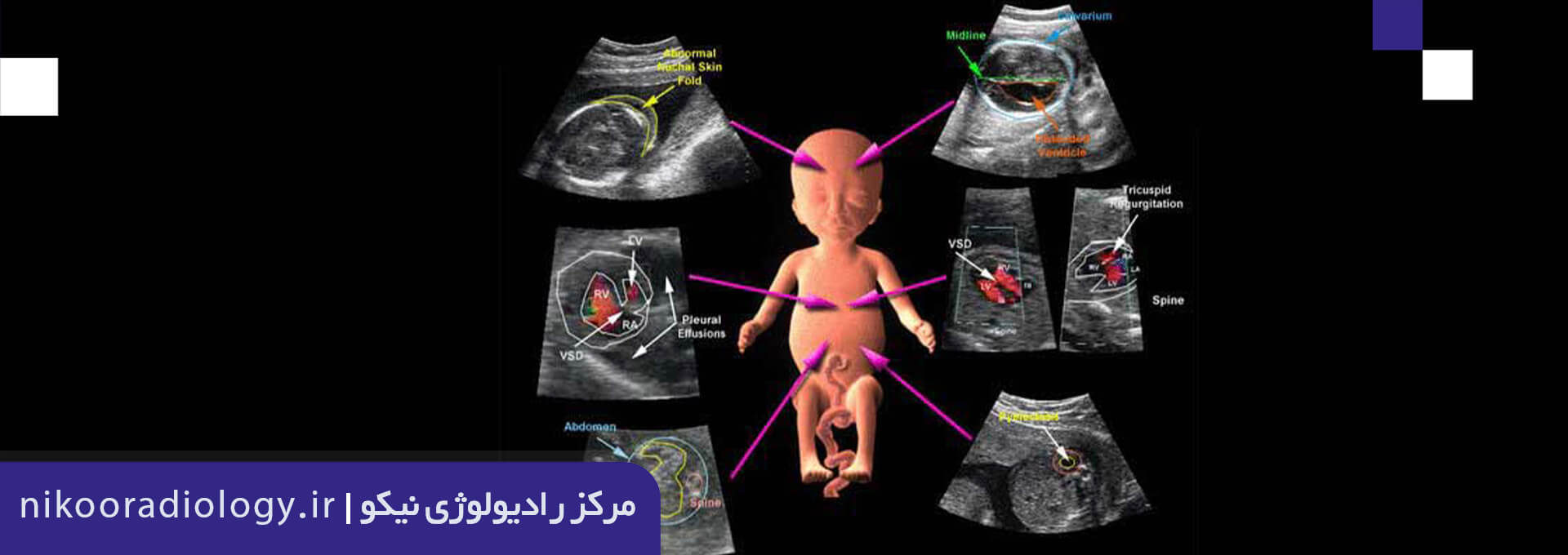 سونوگرافی رشد جنین و داپلر